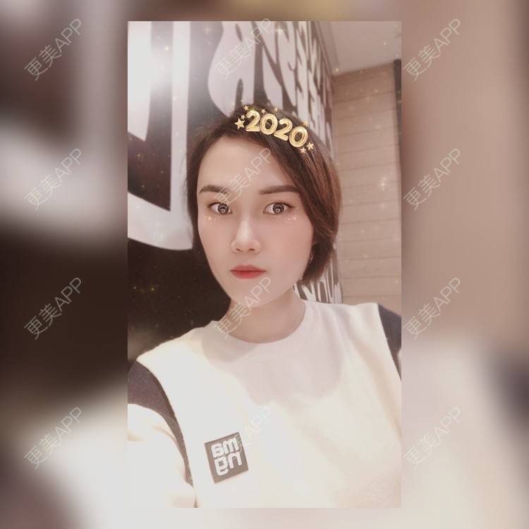 更美 - 安迪🌷的玻尿酸面颊经验 | 视频日记 | 上海 | 玻尿酸面颊