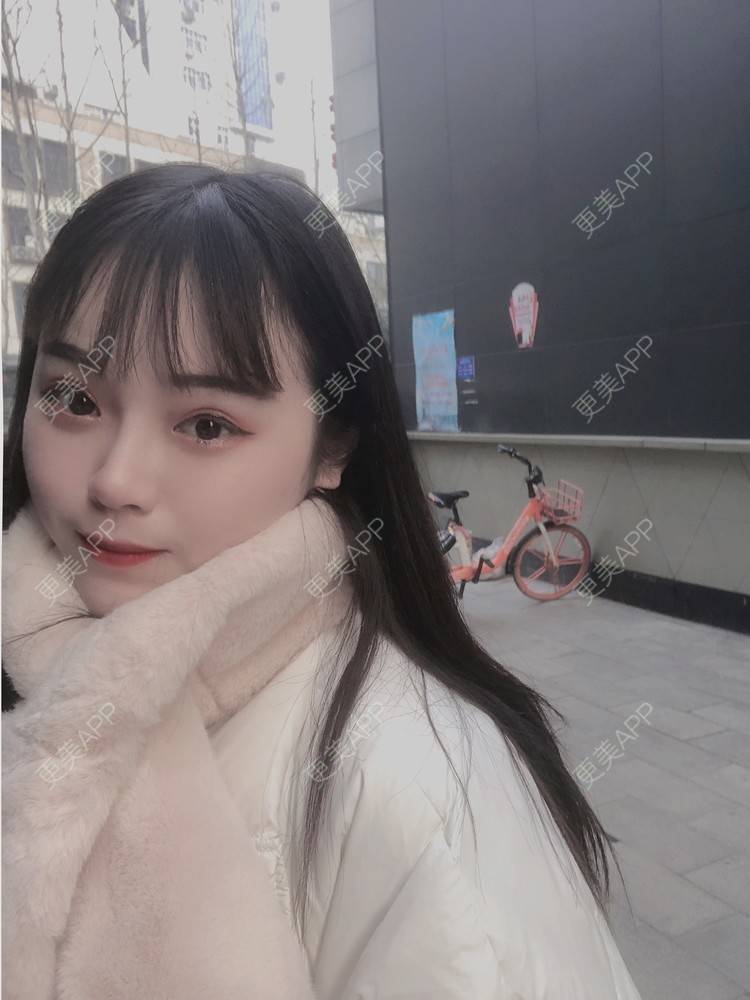 更美 - 格宝宝🍼的肋软骨隆鼻经验 | 肋软骨隆鼻 | 武汉