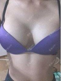 更美 - 头上长犄角的假体隆胸经验 | 视频日记 | 假体隆胸 | 成都