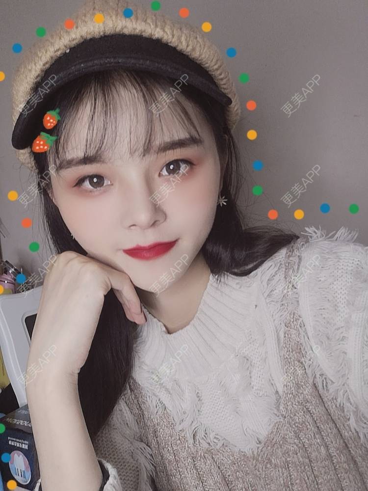 更美 - 莫宁🌸的自体脂肪填充泪沟经验 | 视频日记 | 自体脂肪丰额头 | 自体脂肪填充泪沟 | 自体脂肪丰苹果肌 | 自体脂肪丰面颊 | 自体脂肪丰太阳穴 | 自体脂肪垫下巴 | 广州