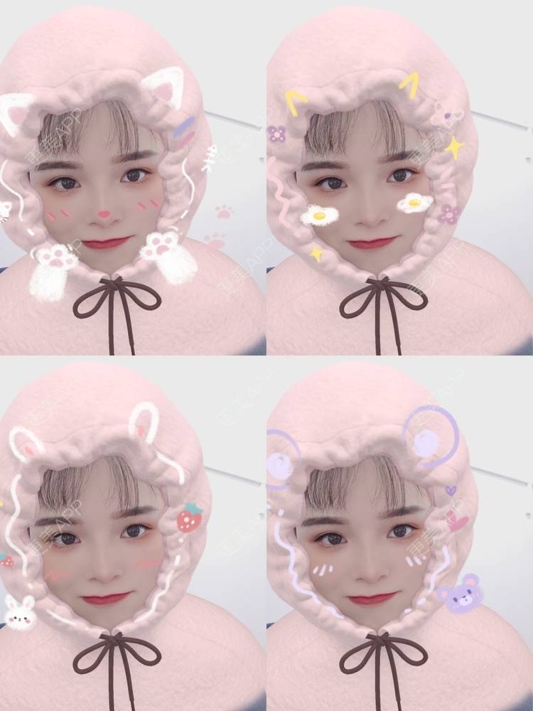 更美 - 莫宁🌸的自体脂肪填充泪沟经验 | 视频日记 | 自体脂肪丰额头 | 自体脂肪填充泪沟 | 自体脂肪丰苹果肌 | 自体脂肪丰面颊 | 自体脂肪丰太阳穴 | 自体脂肪垫下巴 | 广州