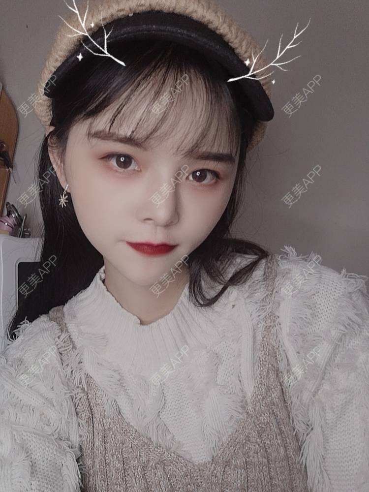 更美 - 莫宁🌸的自体脂肪填充泪沟经验 | 视频日记 | 自体脂肪丰额头 | 自体脂肪填充泪沟 | 自体脂肪丰苹果肌 | 自体脂肪丰面颊 | 自体脂肪丰太阳穴 | 自体脂肪垫下巴 | 广州