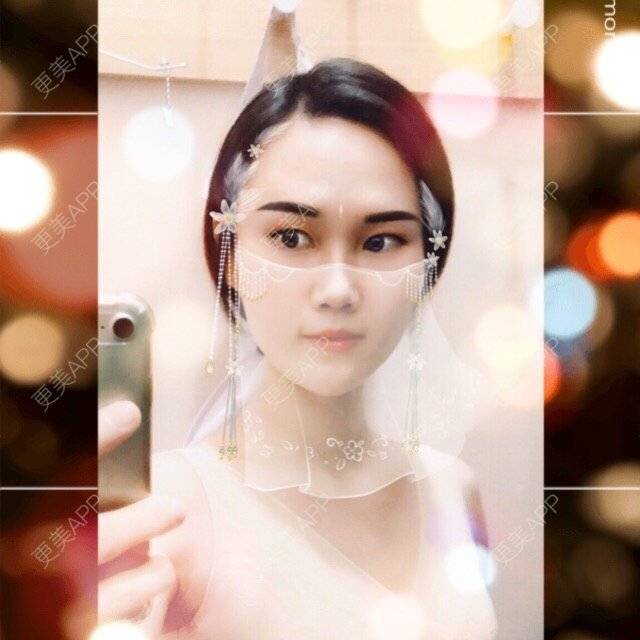 更美 - 安迪🌷的玻尿酸面颊经验 | 视频日记 | 上海 | 玻尿酸面颊
