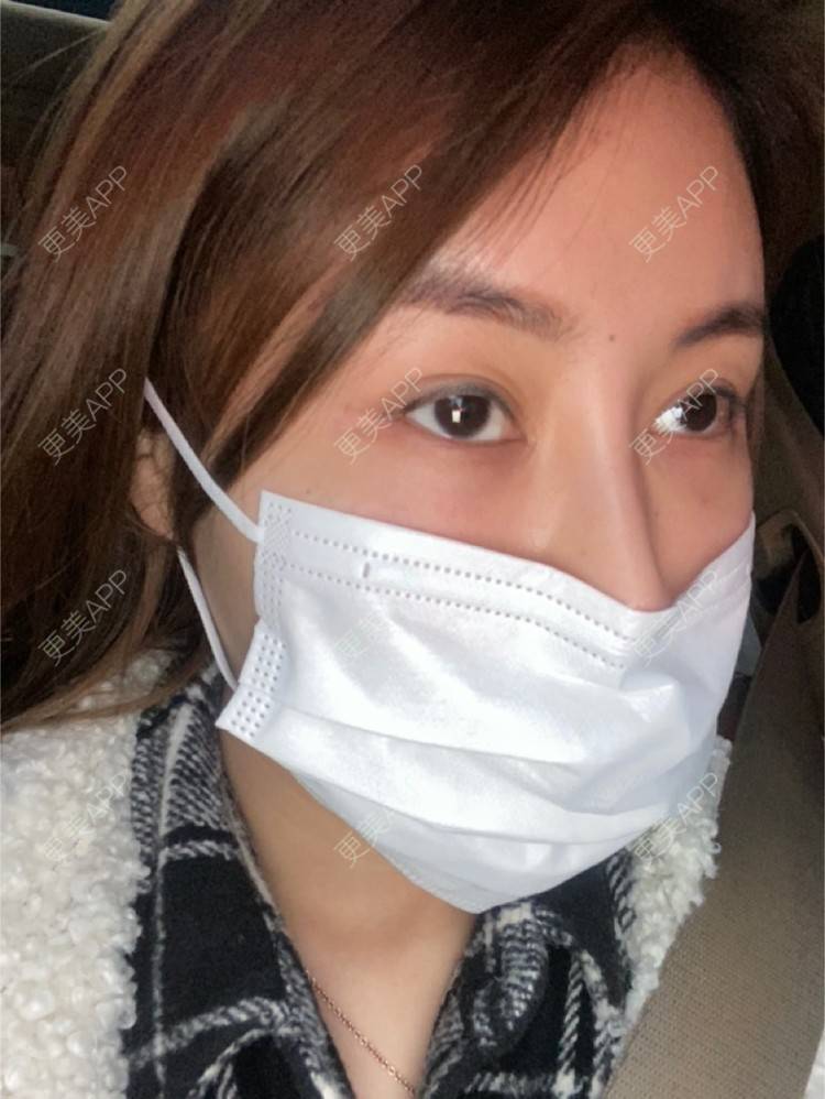 更美 - 嘀嗒💋的胶原蛋白淡化黑眼圈经验 | 上海 | 胶原蛋白淡化黑眼圈