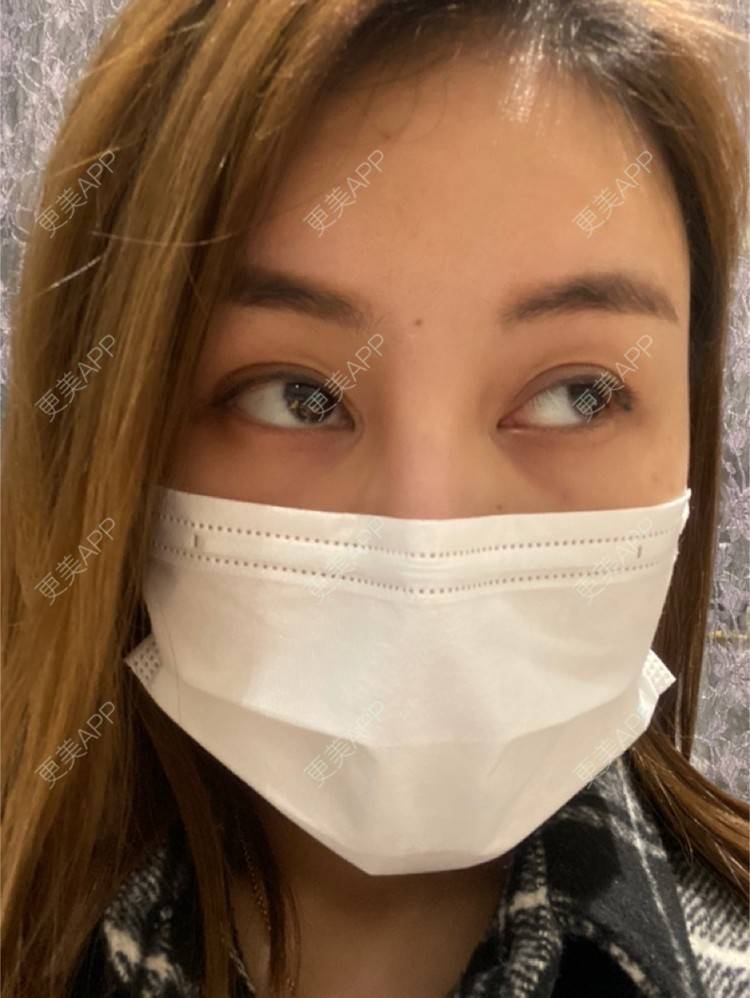 更美 - 嘀嗒💋的胶原蛋白淡化黑眼圈经验 | 上海 | 胶原蛋白淡化黑眼圈