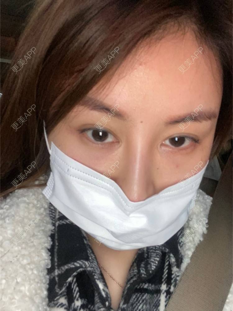 更美 - 嘀嗒💋的胶原蛋白淡化黑眼圈经验 | 上海 | 胶原蛋白淡化黑眼圈