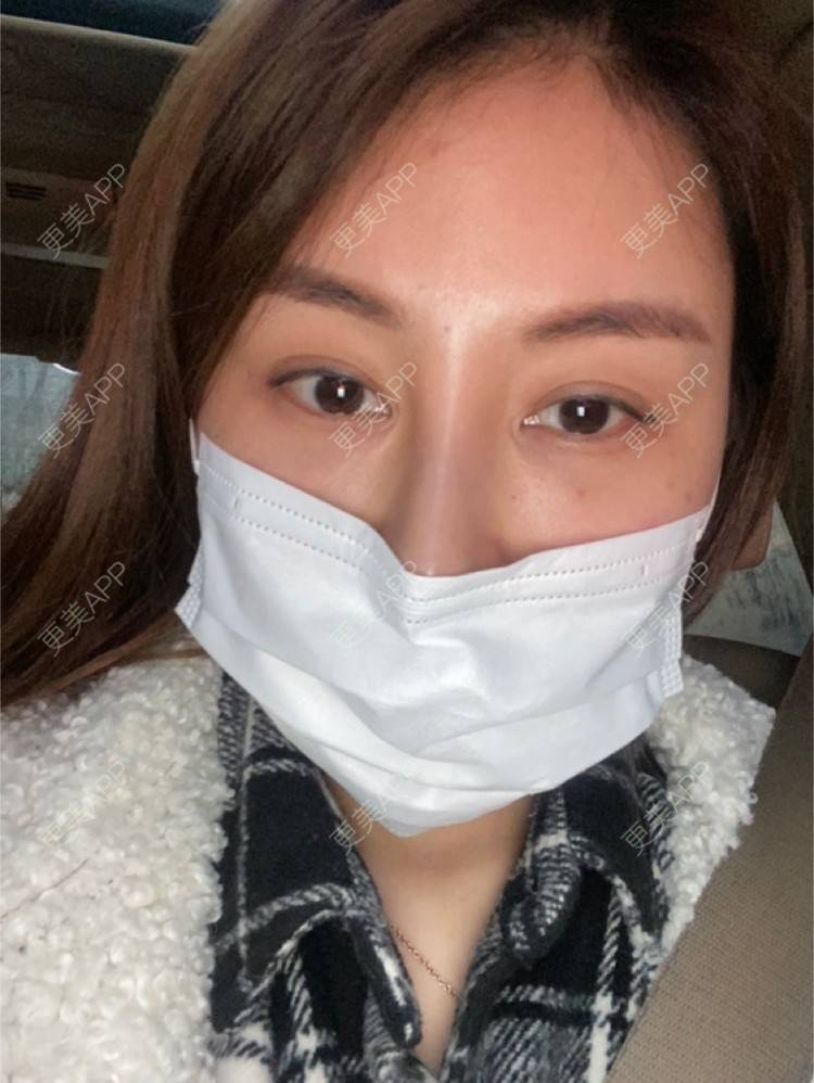 更美 - 嘀嗒💋的胶原蛋白淡化黑眼圈经验 | 上海 | 胶原蛋白淡化黑眼圈