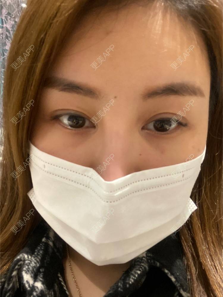更美 - 嘀嗒💋的胶原蛋白淡化黑眼圈经验 | 上海 | 胶原蛋白淡化黑眼圈