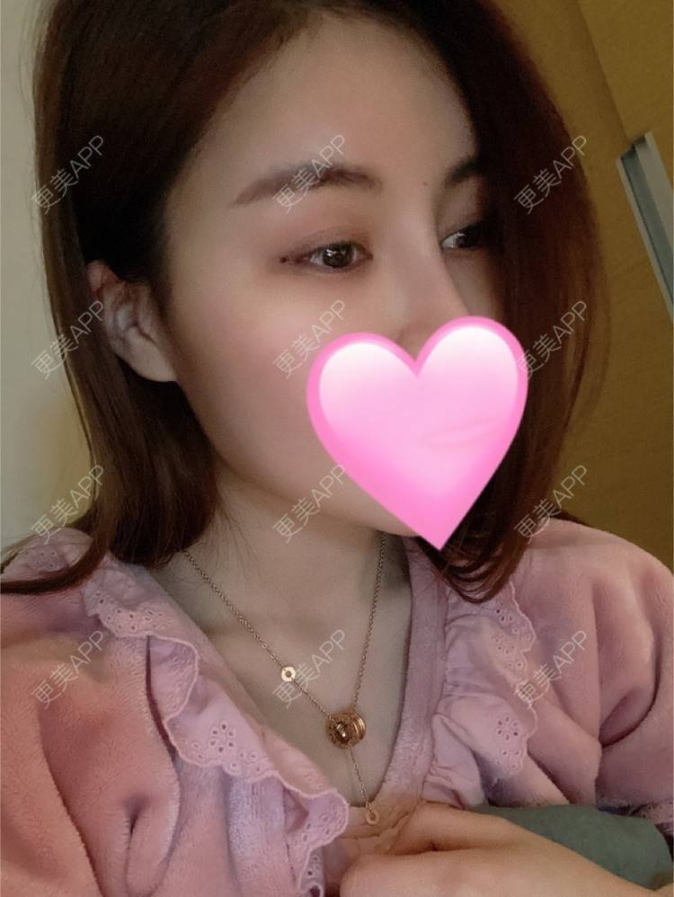 更美 - 嘀嗒💋的胶原蛋白淡化黑眼圈经验 | 上海 | 胶原蛋白淡化黑眼圈