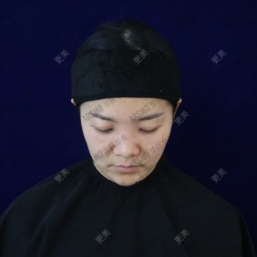 池鱼九