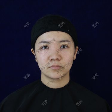 池鱼九