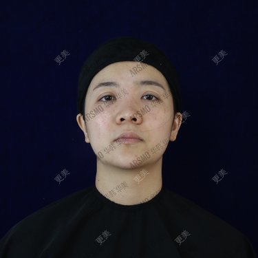 池鱼九