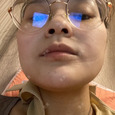 一白遮三丑丑丑