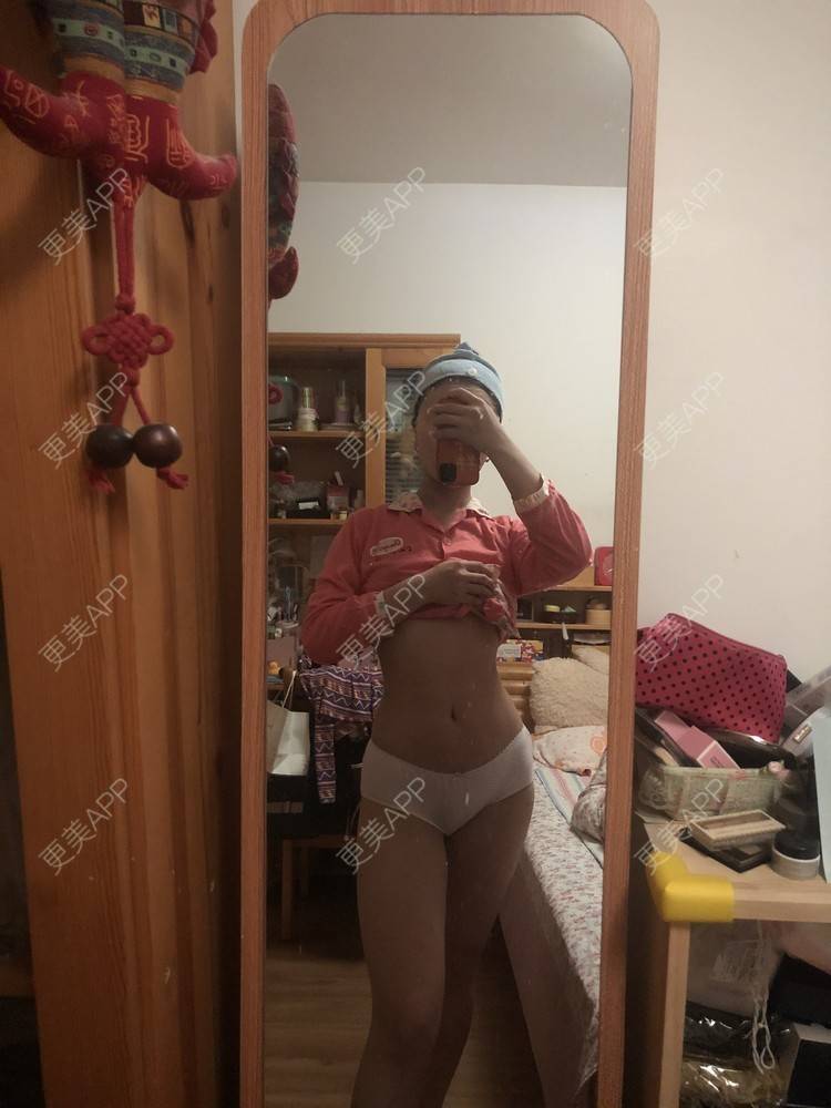 更美 - XXX||XXX的腰腹吸脂经验 | 腰腹吸脂 | 背部吸脂 | 手臂吸脂 | 郑州