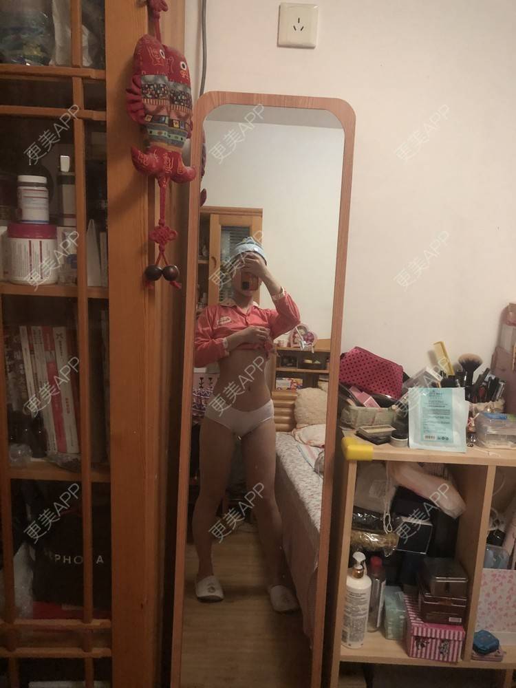 更美 - XXX||XXX的腰腹吸脂经验 | 腰腹吸脂 | 背部吸脂 | 手臂吸脂 | 郑州