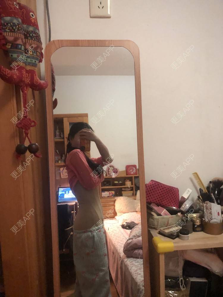 更美 - XXX||XXX的腰腹吸脂经验 | 腰腹吸脂 | 背部吸脂 | 手臂吸脂 | 郑州