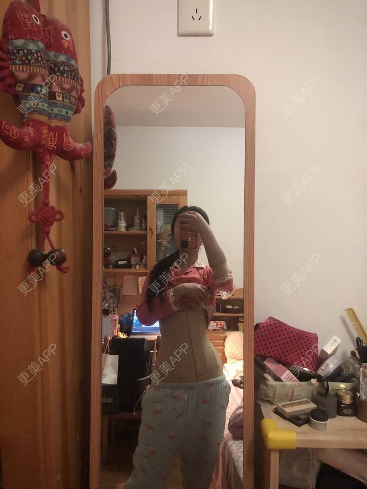 更美 - XXX||XXX的腰腹吸脂经验 | 腰腹吸脂 | 背部吸脂 | 手臂吸脂 | 郑州