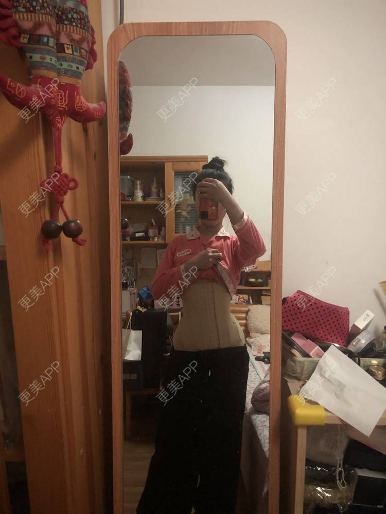 更美 - XXX||XXX的腰腹吸脂经验 | 腰腹吸脂 | 背部吸脂 | 手臂吸脂 | 郑州