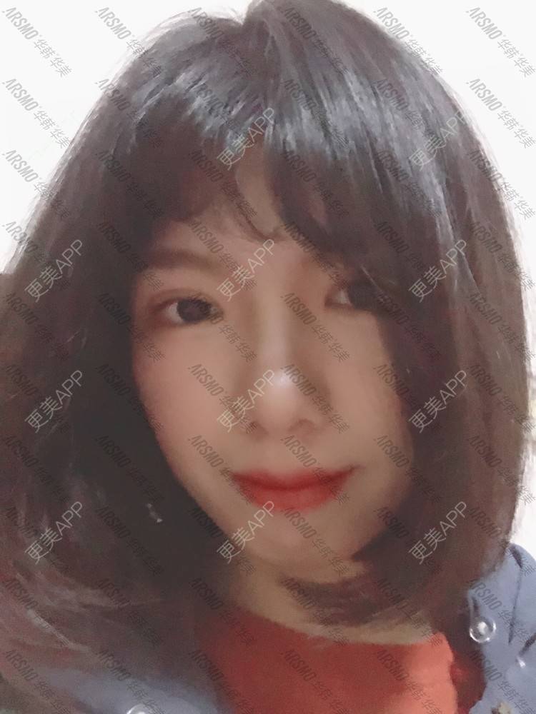 更美 - 无辣不欢但不要太辣的全切双眼皮经验 | 视频日记 | 全切双眼皮 | 开内眼角 | 上眼睑去脂 | 眼部多项 | 长沙