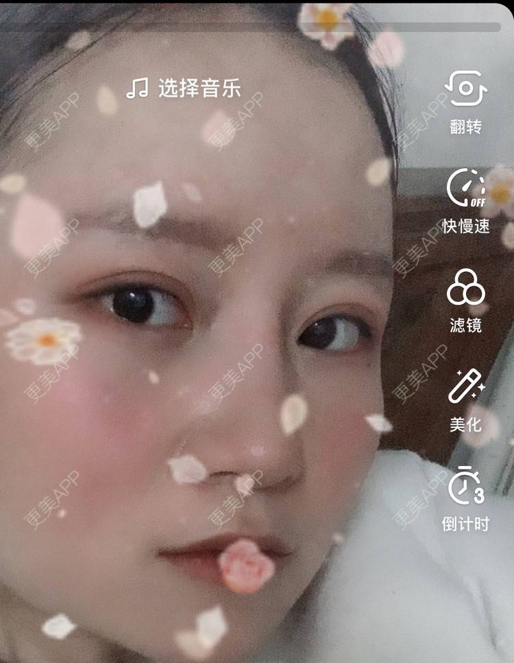 更美 - 圆方脸课代表ʚ😊ɞ的隆鼻经验 | 隆鼻 | 假体垫鼻基底 | 鼻部多项 | 全切双眼皮 | 自体软骨垫鼻尖 | 硅胶隆鼻 | 南京 | 耳软骨隆鼻 | 视频日记