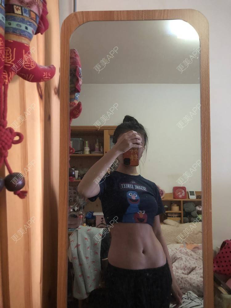 更美 - XXX||XXX的腰腹吸脂经验 | 腰腹吸脂 | 背部吸脂 | 手臂吸脂 | 郑州