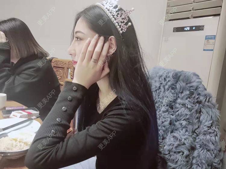 更美 - 更美用户mv8Hdro3pR的鼻部多项经验 | 青岛 | 鼻部多项