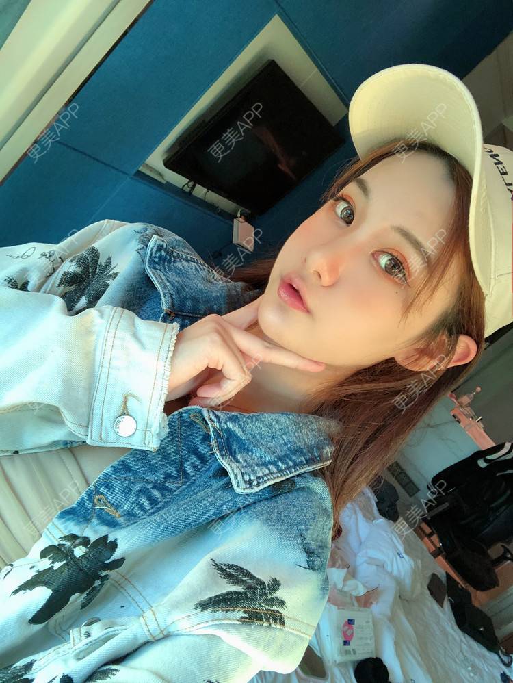 更美 - 更美用户cA33i6DxJX的玻尿酸下巴经验 | 玻尿酸下巴 | 上饶