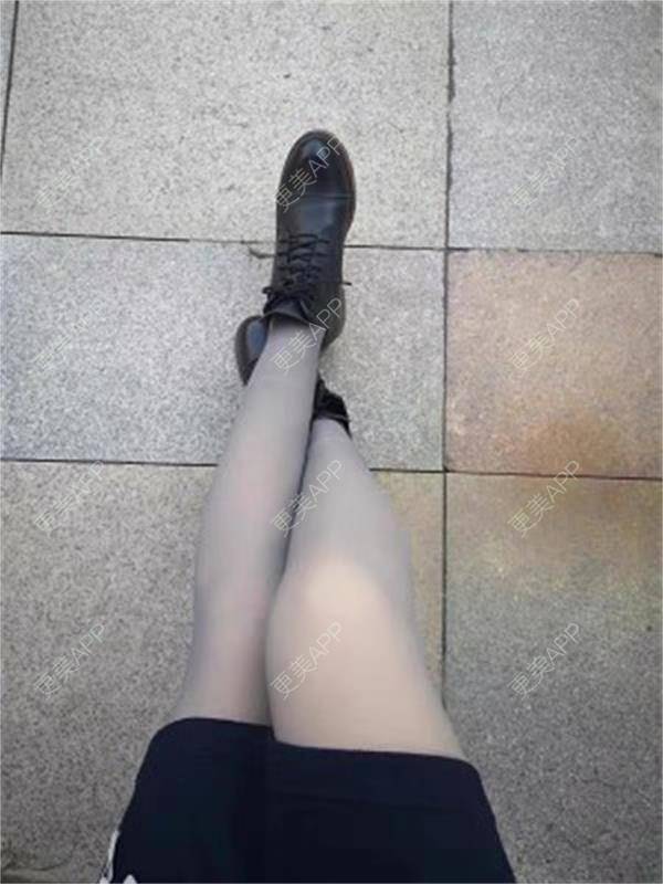 更美 - 更美用户TH8dGraaIO的激光淡化妊娠纹经验 | 激光淡化妊娠纹
