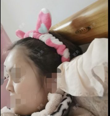 鼻部多项