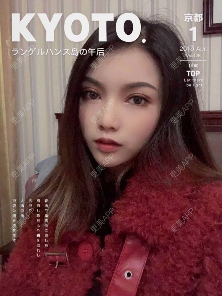 更美 - 更美用户T3PhxaY9Vo的玻尿酸下巴经验 | 广州 | 视频日记 | 玻尿酸下巴