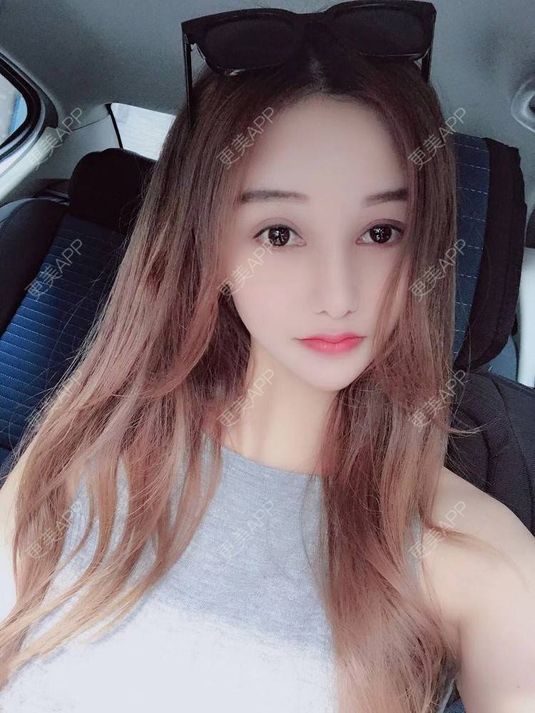 更美 - 杰拉德点女的肋软骨隆鼻经验 | 视频日记 | 杭州 | 肋软骨隆鼻 | 隆鼻 | 更美研究所