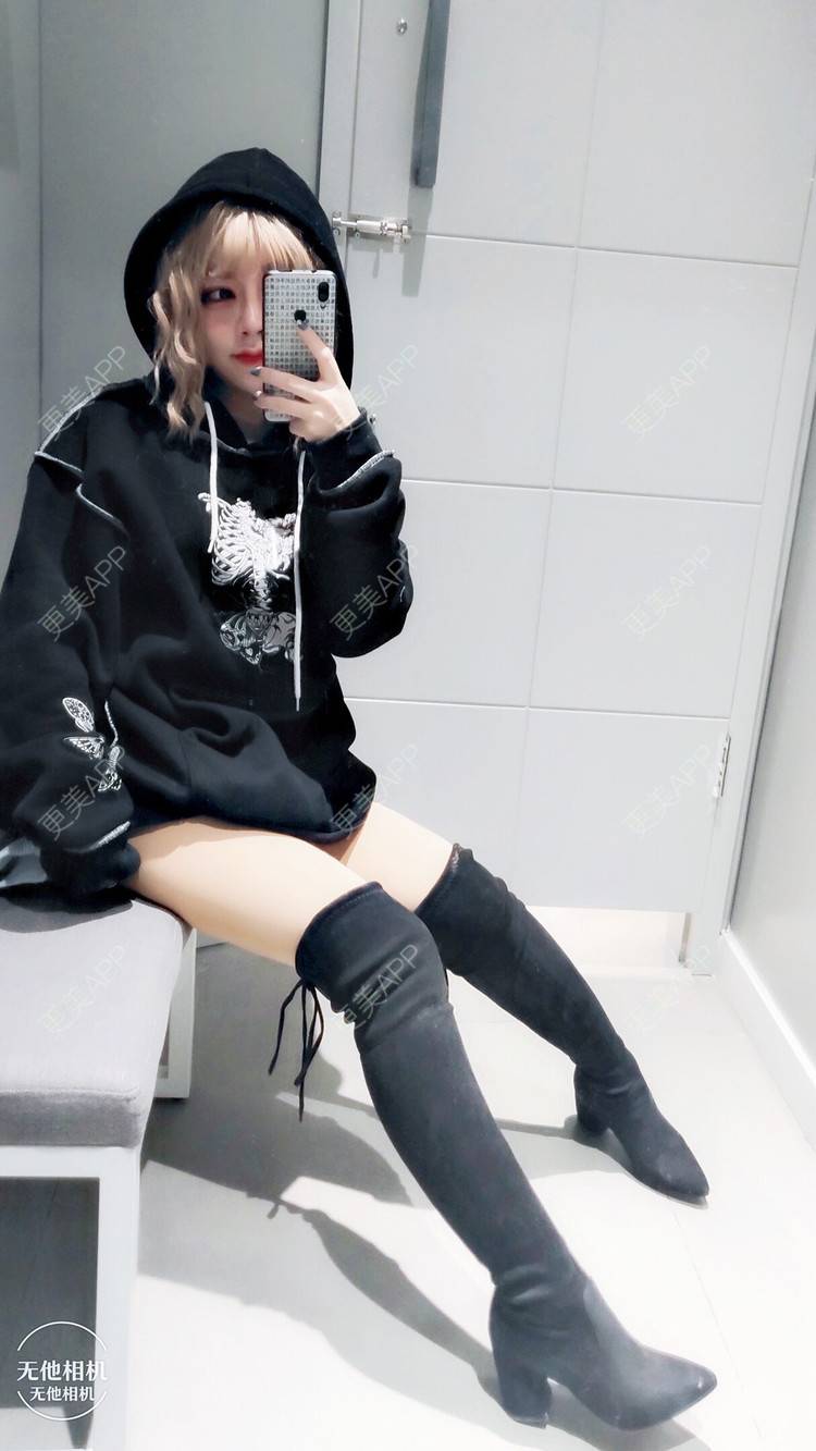 吸脂瘦大腿前后对比照_刀恋孤光63押兜吸脂瘦大腿前后对比照_术后