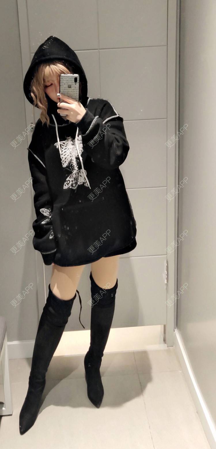 吸脂瘦大腿前后对比照_刀恋孤光63押兜吸脂瘦大腿前后对比照_术后