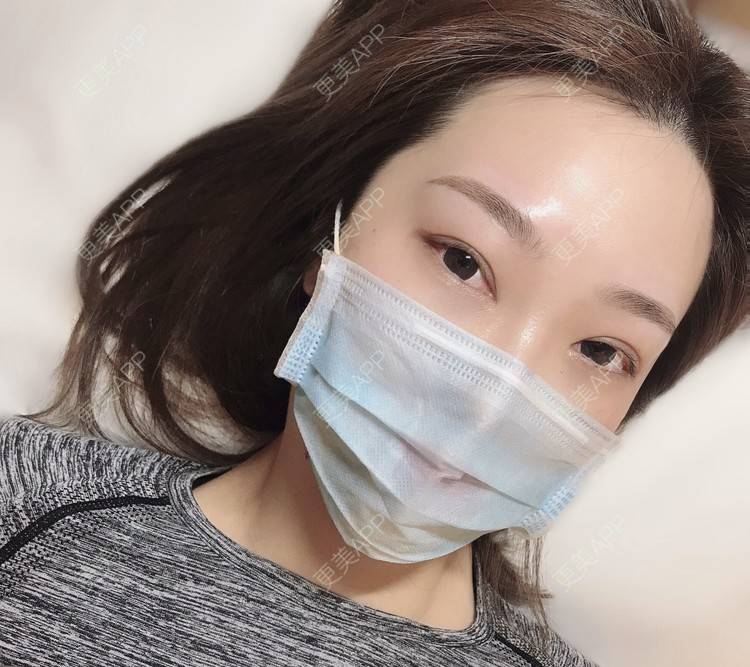 更美 - SKbaby的半永久纹眉经验 | 上海 | 半永久纹眉