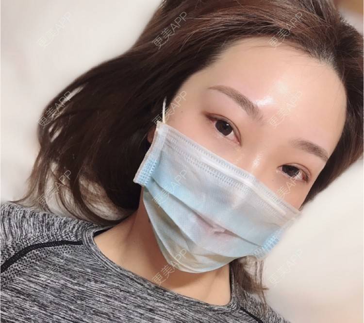 更美 - SKbaby的半永久纹眉经验 | 上海 | 半永久纹眉