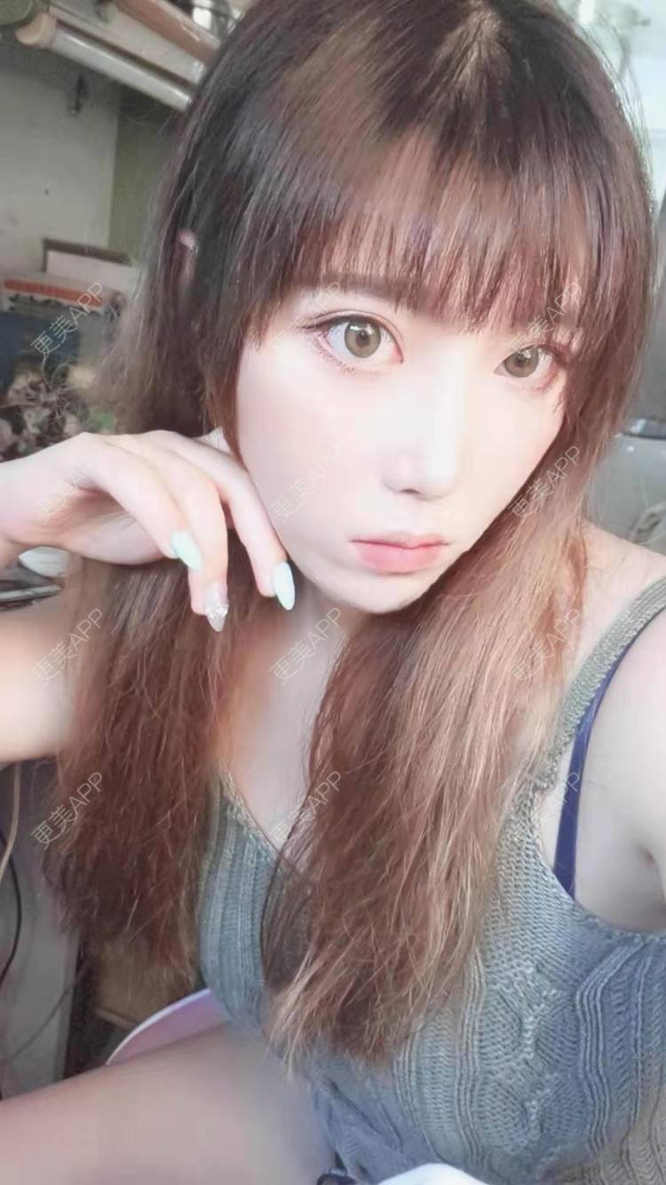 更美 - 更美用户oTj2WxMsId的厚唇改薄经验 | 深圳 | 厚唇改薄