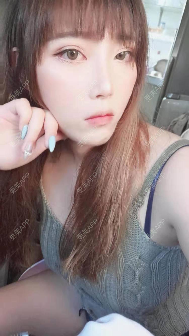更美 - 更美用户oTj2WxMsId的厚唇改薄经验 | 深圳 | 厚唇改薄