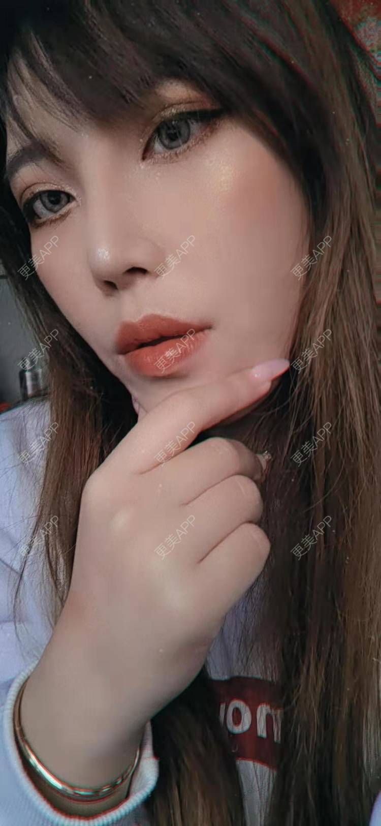 更美 - 更美用户oTj2WxMsId的厚唇改薄经验 | 深圳 | 厚唇改薄