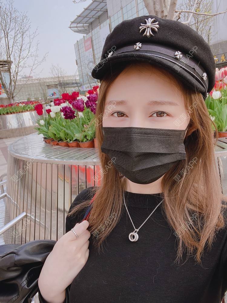 更美 - Jennie🌸小悦儿的开外眼角经验 | 开外眼角 | 提眉修复 | 视频日记 | 上海