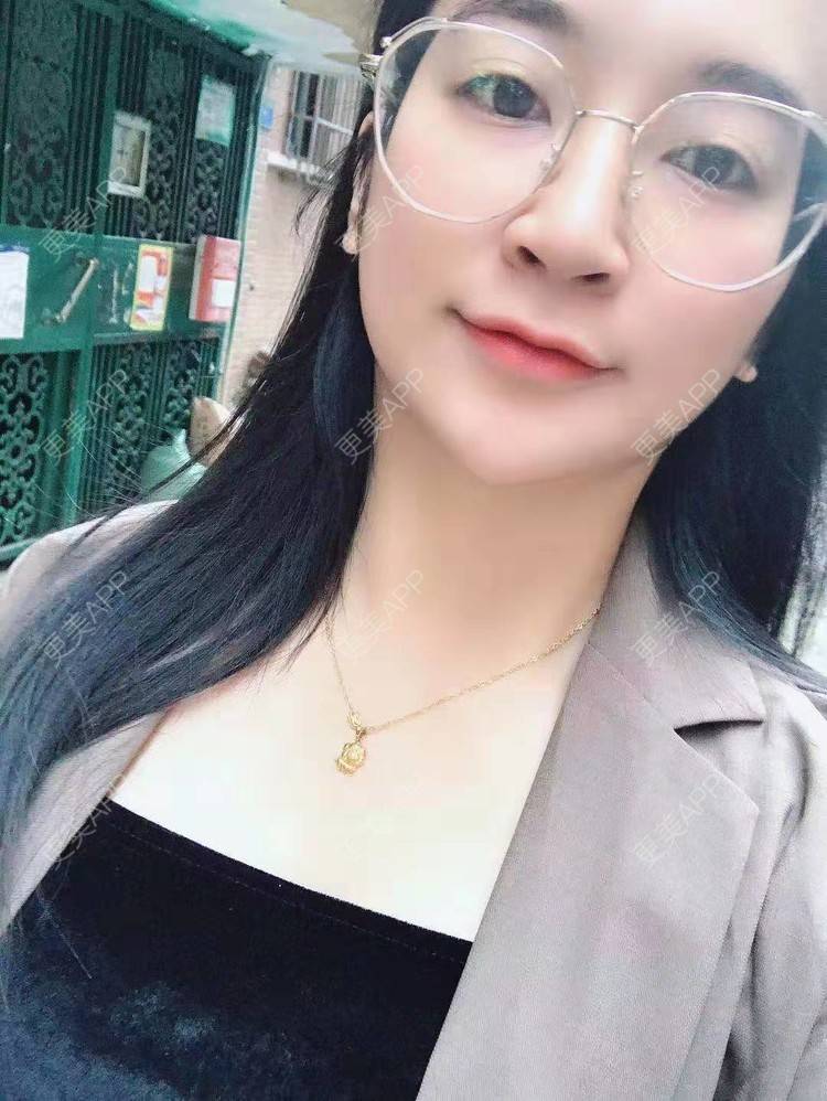 更美 - 更美用户129LF9Yh6a的玻尿酸下巴经验 | 视频日记 | 玻尿酸下巴 | 广州