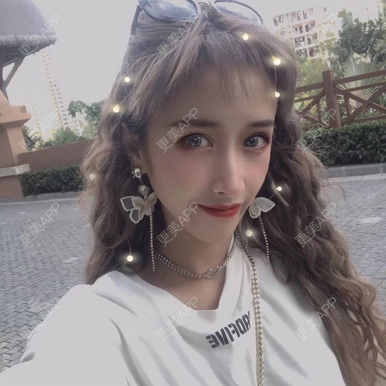 更美 - 丢了灵魂的孩纸的唇腭裂修复经验 | 唇腭裂修复 | 厚唇改薄 | 玻尿酸唇部 | 自体脂肪丰唇 | 胶原蛋白丰唇