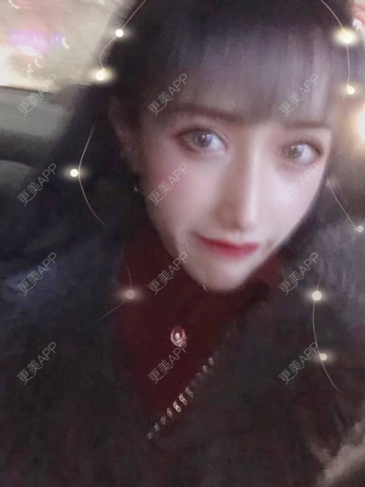 更美 - 丢了灵魂的孩纸的唇腭裂修复经验 | 唇腭裂修复 | 厚唇改薄 | 玻尿酸唇部 | 自体脂肪丰唇 | 胶原蛋白丰唇