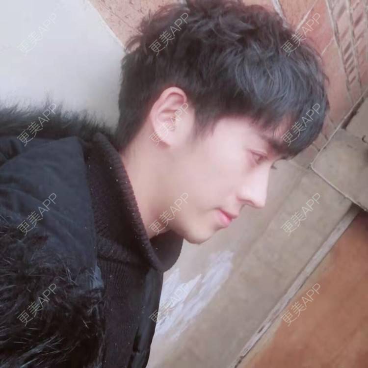 更美 - LongL的隆鼻经验 | 鼻部多项 | 手术缩鼻头 | 自体软骨垫鼻尖 | 肋软骨隆鼻 | 鼻中隔软骨垫鼻头 | 注射缩鼻头 | 鼻小柱缩短