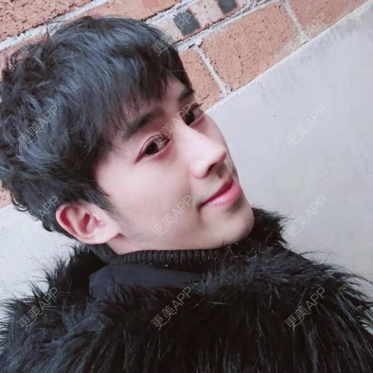 更美 - LongL的隆鼻经验 | 鼻部多项 | 手术缩鼻头 | 自体软骨垫鼻尖 | 肋软骨隆鼻 | 鼻中隔软骨垫鼻头 | 注射缩鼻头 | 鼻小柱缩短