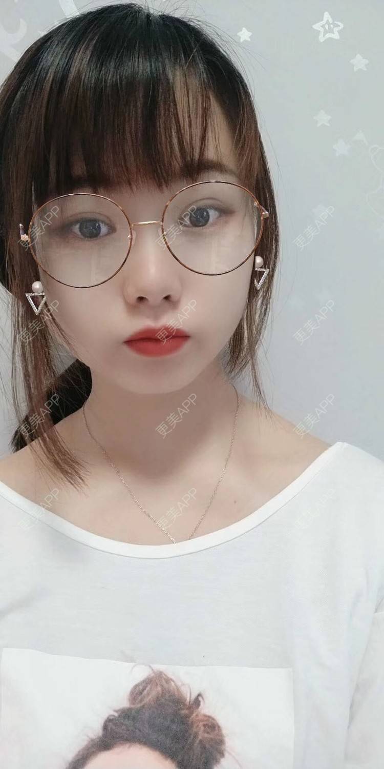 更美 - 米连菊 医生的玻尿酸鼻部经验 | 广州 | 玻尿酸鼻部