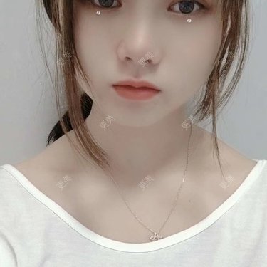 米连菊 医生