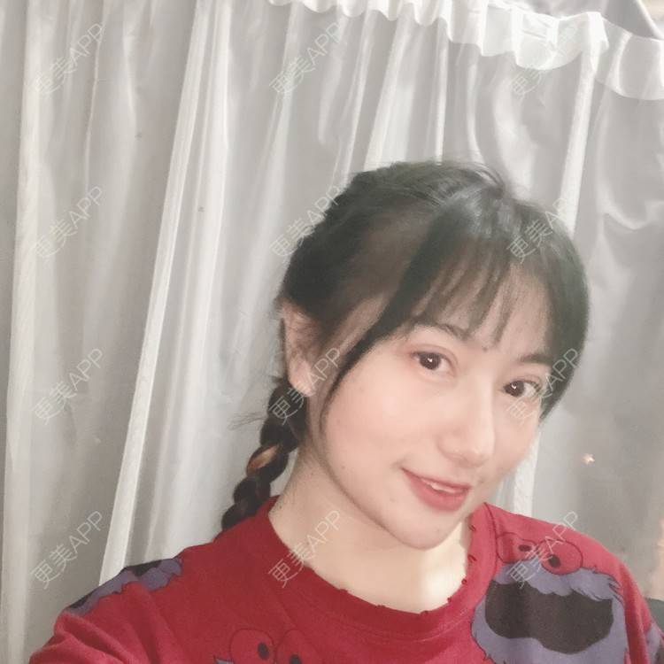 更美 - 哈哈哈镜星的吸脂瘦脸经验 | 吸脂瘦脸 | 西安 | 自体脂肪全面部填充