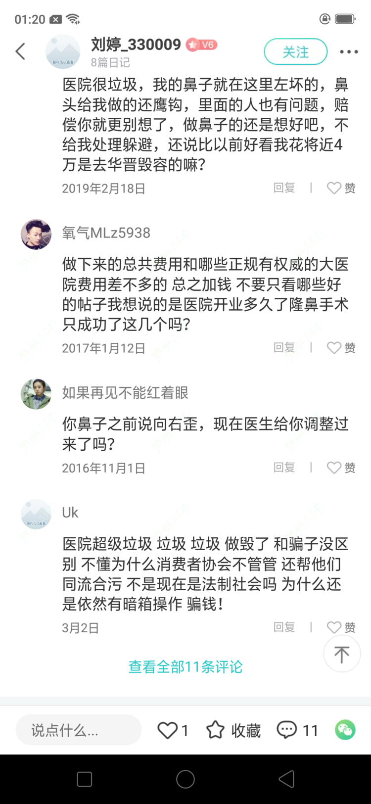 更美 - 本人的失败经历的硅胶隆鼻经验 | 硅胶隆鼻 | 上海