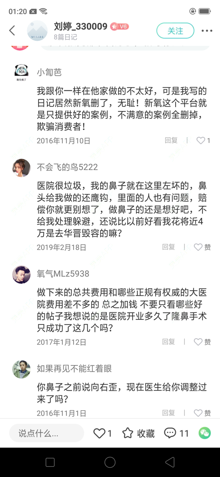 更美 - 本人的失败经历的硅胶隆鼻经验 | 硅胶隆鼻 | 上海