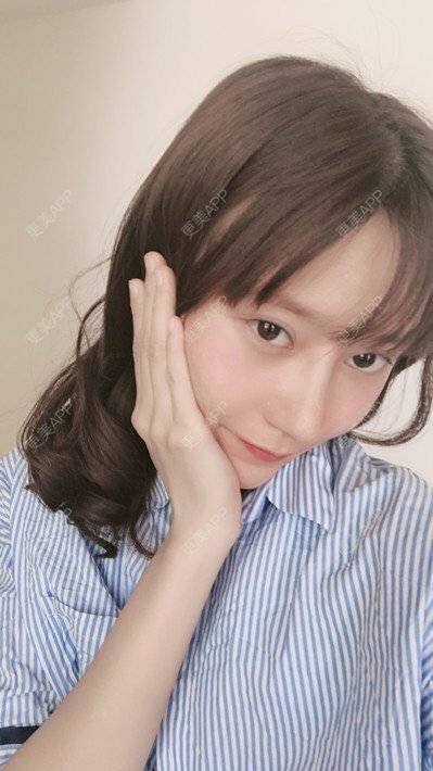 更美 - 更美用户58UrXXkMuu的鼻部多项经验 | 鼻部多项 | 鼻翼缩小 | 人工骨隆鼻 | 长鼻矫正 | 自体肋软骨垫鼻基底 | 福州
